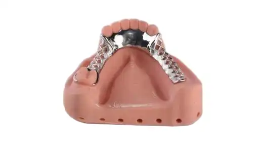 How Can Metal Chrome Partial Framework Enhance Dental Restoration?